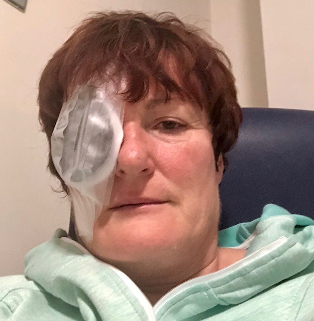 Elaine O’Callaghan after treatment